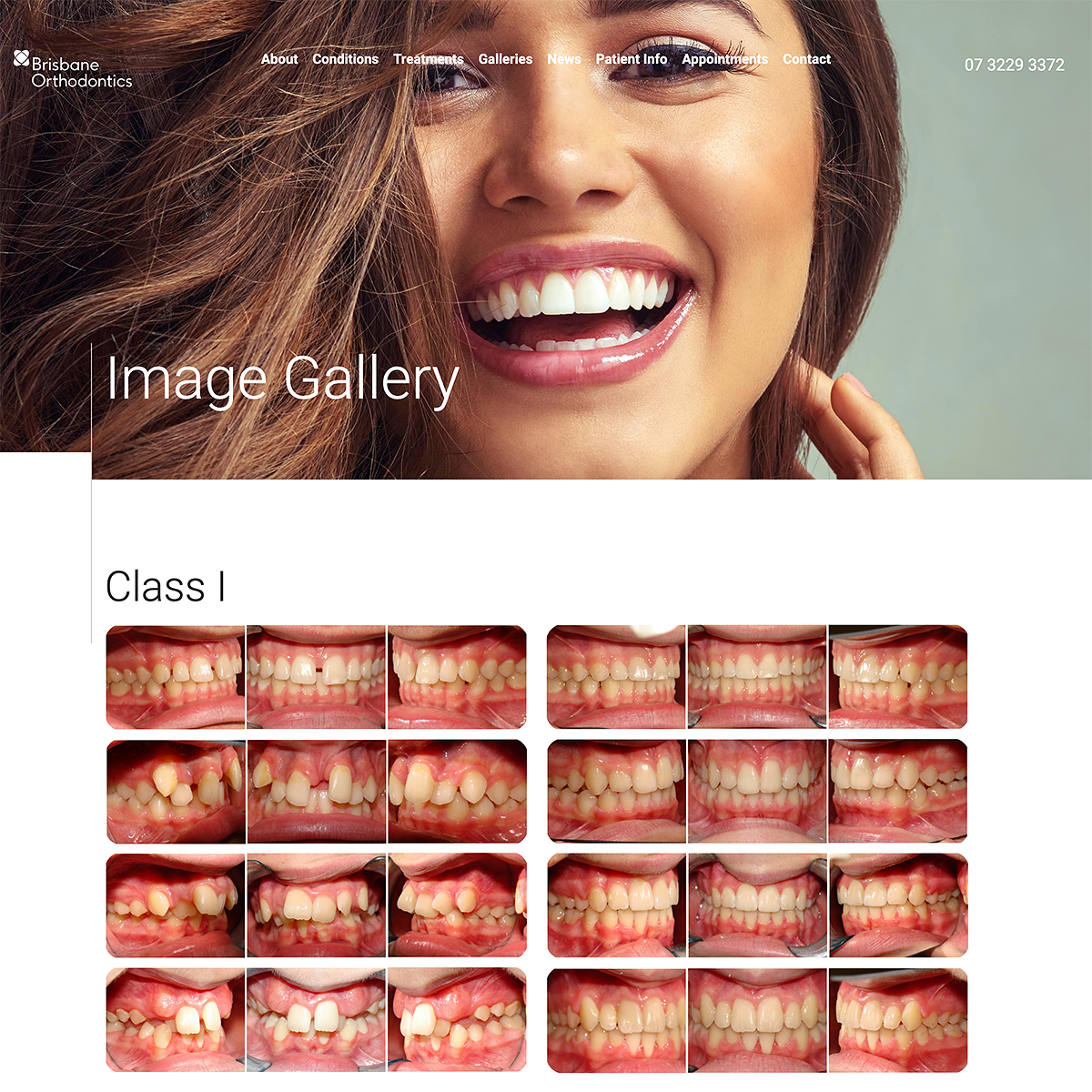 Brisbane Orthodontics - Image Gallery
