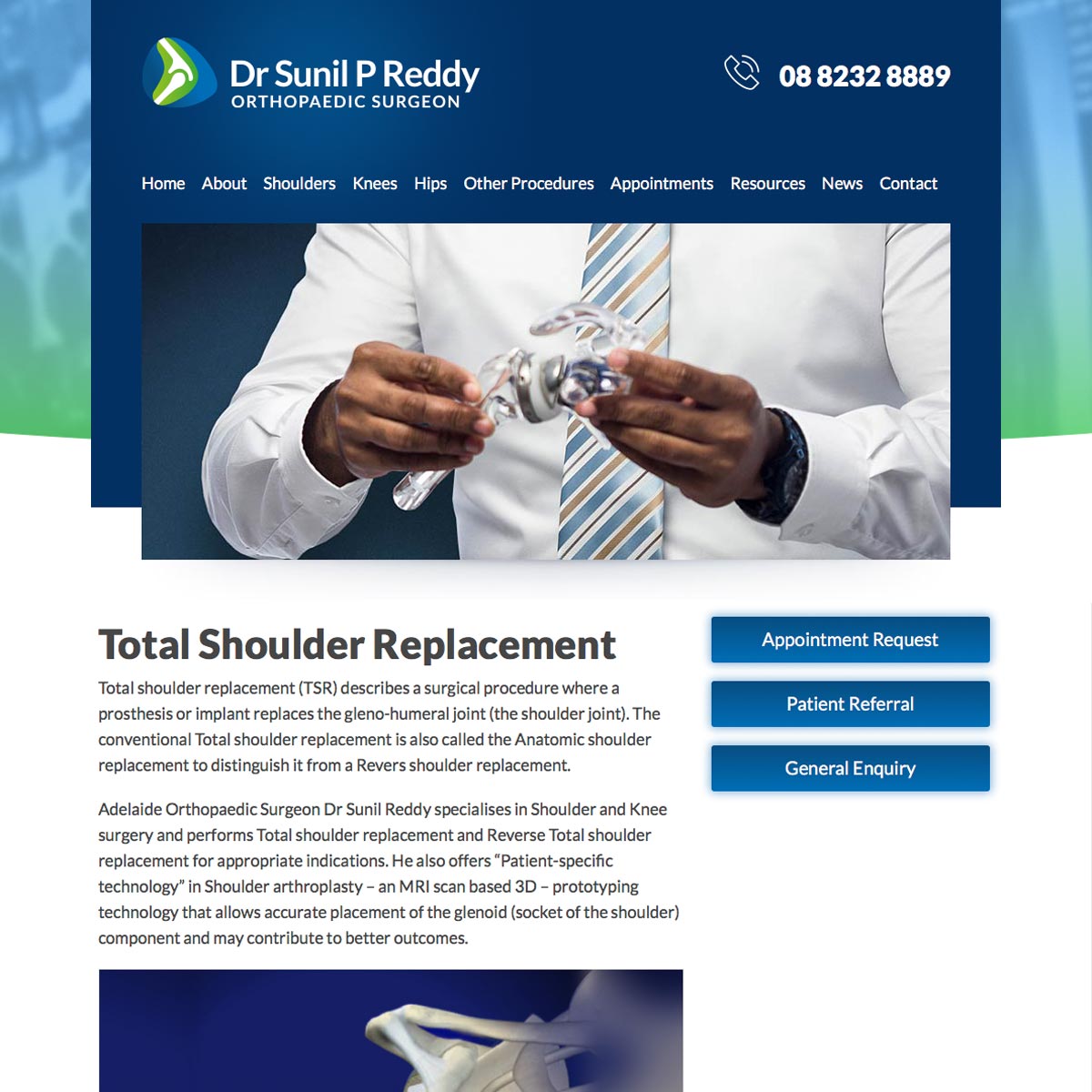 Dr Sunil Reddy - Total Shoulder Replacement