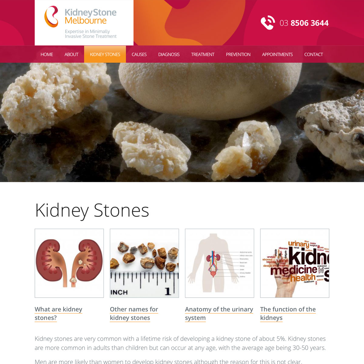 Kidney Stone Melbourne - Kidney Stones